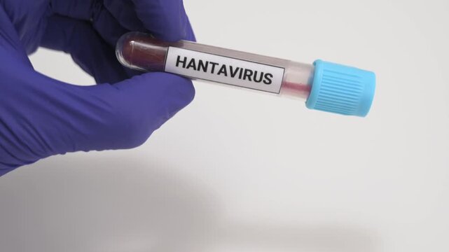 Close up of a scientist holding a hantavirus blood test tube on a white background