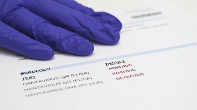 Doctor's gloved hand presenting a positive hantavirus lab test result isolated on white background