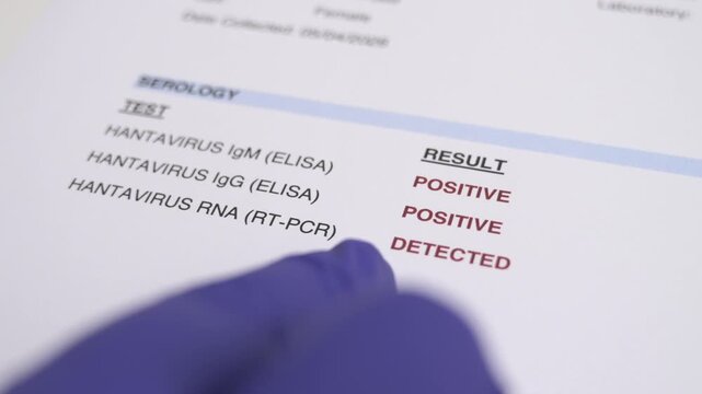 A close view of a medical report shows the results for hantavirus tests. Both IgM and IgG show positive results. The presence of hantavirus RNA is also detected.
