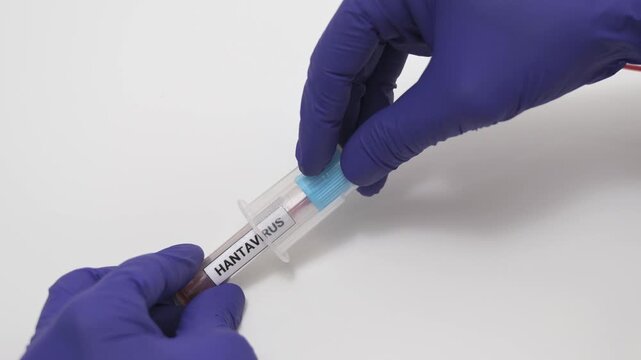 Medical professional drawing a blood sample into a vial for hantavirus testing on white background