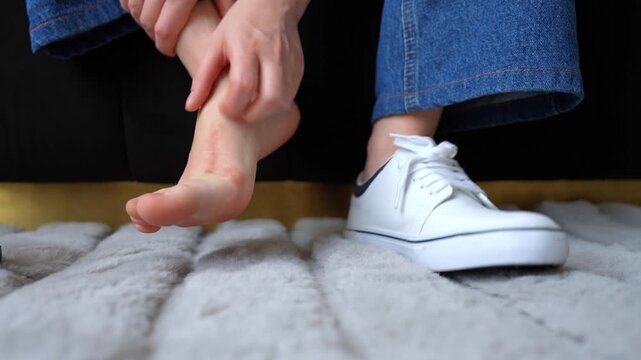 Young woman removes shoes and scratches itchy feet between toes. Concept of skin irritation, fungal infection risk, discomfort, hygiene and foot care in everyday life. 