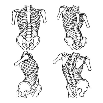 Scoliosis. human spine deformities in different angles. medical line art vector illustration.