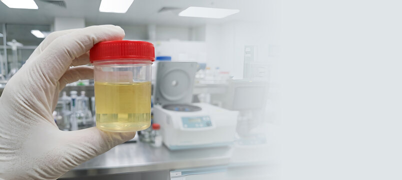 Horizontal laboratory background with a hand holding a diagnostic urine specimen
