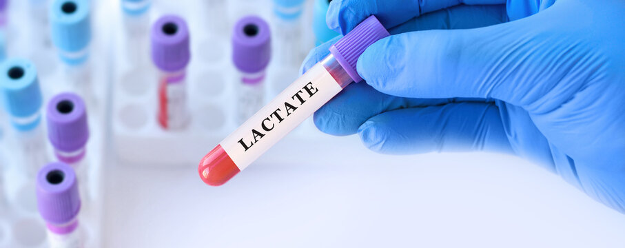 Doctor holding blood sample tube with lactate test in modern medical laboratory, biochemical blood analysis concept for diagnostics of metabolism, hypoxia, acidosis and emergency healthcare monitoring
