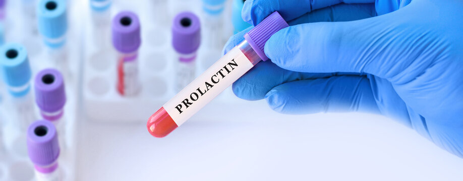 Doctor holding blood sample tube with prolactin test in modern laboratory, hormonal blood analysis for endocrine system evaluation, fertility assessment and professional medical diagnostics