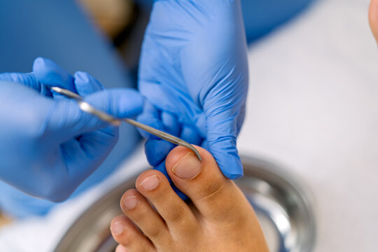 Podiatrist treating toenail, performing foot care procedure