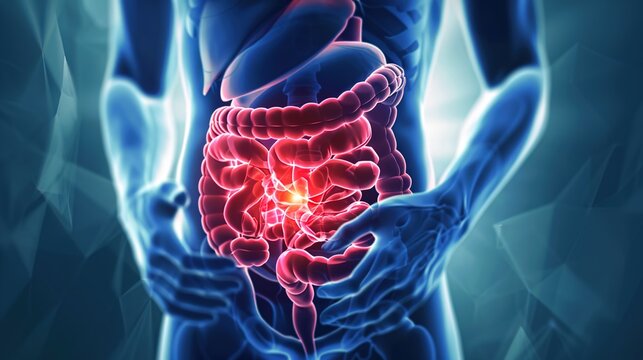 Inflammatory Bowel Disease 3D medical anatomical illustration, chronic inflammatory disorder of human digestive tract and intestinal lining, bowel inflammation, Crohn&rsquo;s disease and ulcerative colitis 