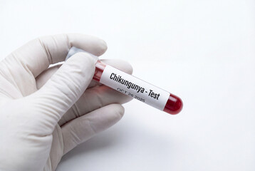 Naklejka premium Gloved hand holding blood sample tube for chikungunya test
