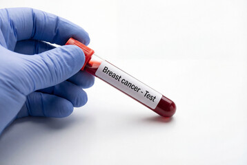 Obraz premium Gloved hand holding blood sample tube labeled breast cancer test medical
