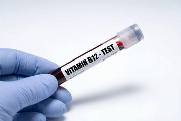 Fototapeta premium Gloved hand holding blood sample tube for vitamin b12 test