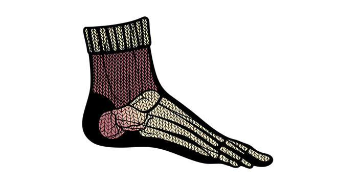Human foot skeleton inside a cozy knitted winter sock