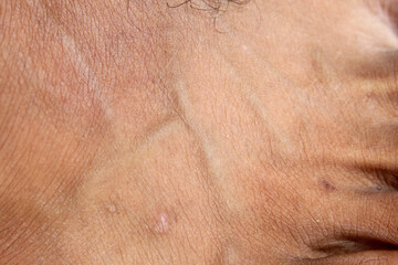 Fototapeta premium Detailed texture of adult male skin with fine wrinkles, thin hair, and clearly visible vein lines.