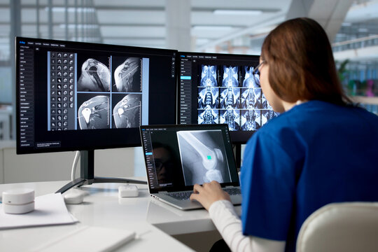 Doctor Studies Knee And Shoulder MRI Scans On Laptop