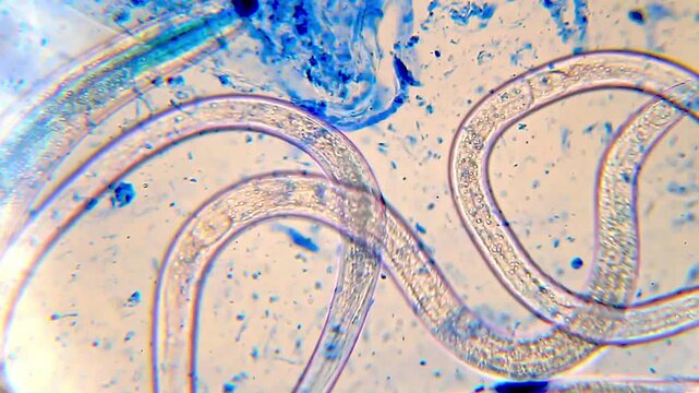 Nematodes actively moving in blue water droplet under 400x magnification brightfield microscopy. 4K scientific microscopy footage.