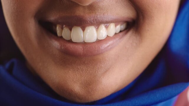 Woman, mouth and smile with teeth for oral hygiene, satisfaction and dentistry treatment for wellness. Female person, orthodontics and dental health for tooth care, fresh breath or happy for veneers.