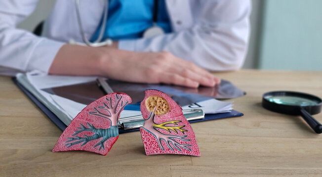 Medical student studies model of human lungs while preparing for exam