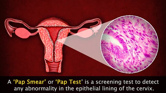 Educational 3D animation explaining Pap smear procedure and cervical cancer screening process clearly.