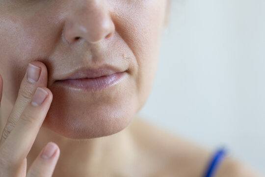 Woman with excessive hair on her face. A mole with hair on female face. Closeup.