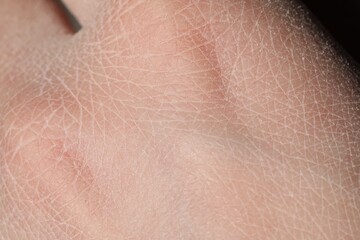 Fototapeta premium Man with dry skin on his hand, closeup