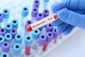 Naklejka premium Doctor holding blood sample tube with hantavirus test in clinical laboratory, viral infection diagnostics, epidemiology research and healthcare analysis concept