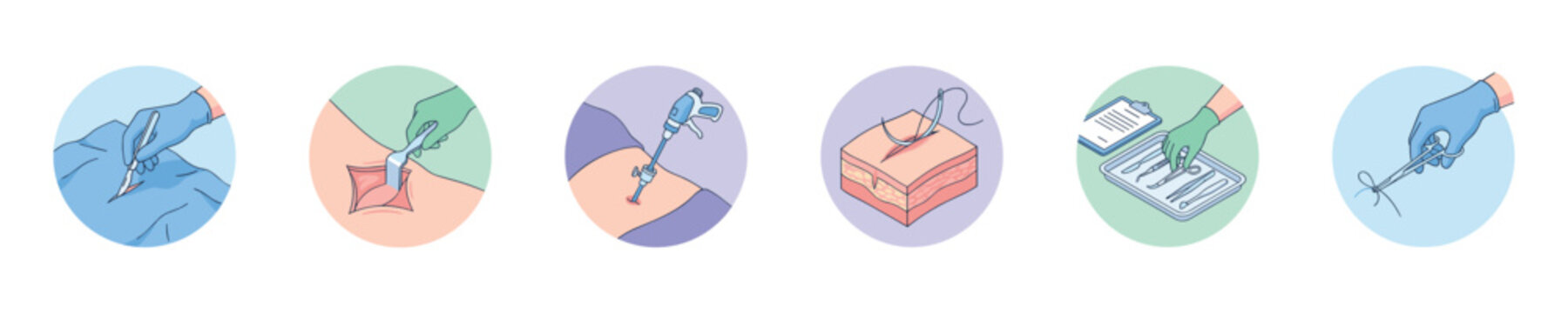 Surgical procedure steps illustrated with icons showing incision, retraction, trocar insertion, suturing, and instrument handling