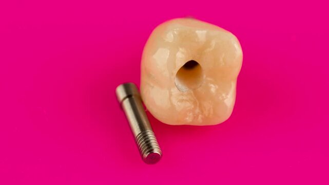 ceramic dental crown for fixation on  dental implant isolation on pink background