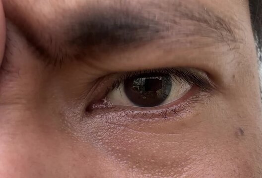 Macro View of Mans Eyes Changing From Calm to Angry Expressions