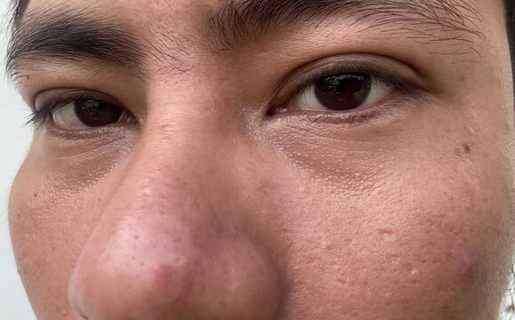 Macro View of Mans Eyes Changing From Calm to Angry Expressions