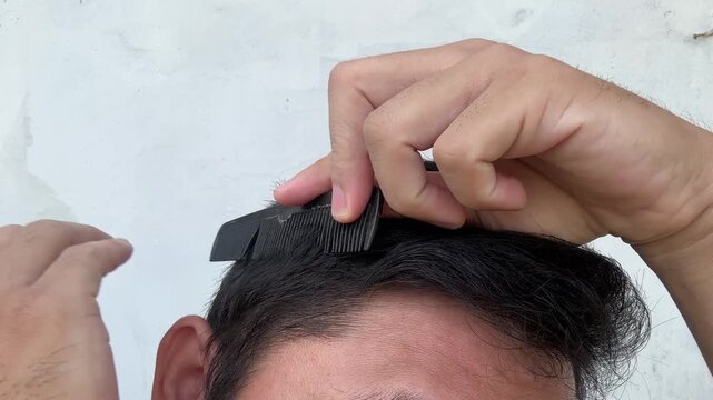 Man examining receding hairline and thinning hair during self-check