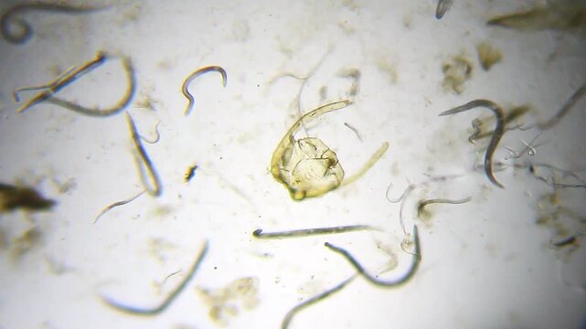 Nematodes actively moving under 40x magnification brightfield microscopy. 4K scientific microscopy footage.