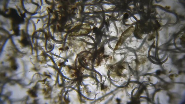 Nematodes aggregation actively moving under 40x magnification brightfield microscopy. 4K scientific microscopy footage.