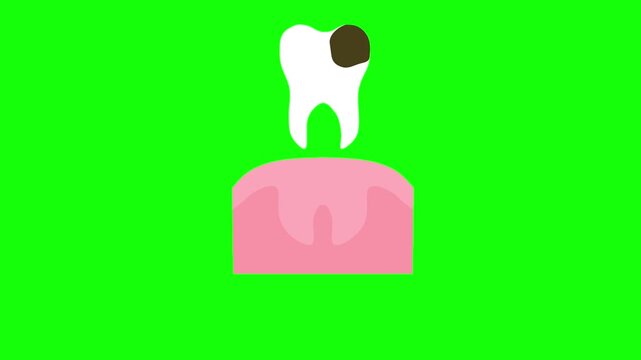 Animation of a toothache caused by a cavity on a green background. A tooth with a flashing effect indicating pain. The concept of maintaining dental hygiene.