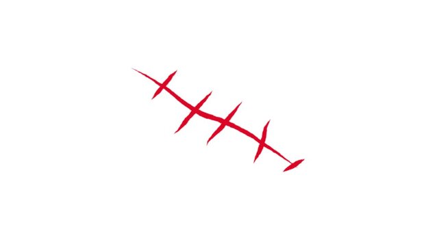 Animation of stitches after surgery, red wound, thin lines on a white background. 4k video