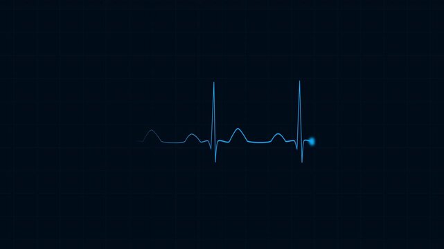 Digital cardiogram display showing a healthy heartbeat rhythm on a medical monitor screen with an oscilloscope wave pattern for healthcare and technology concepts. 4K animation video