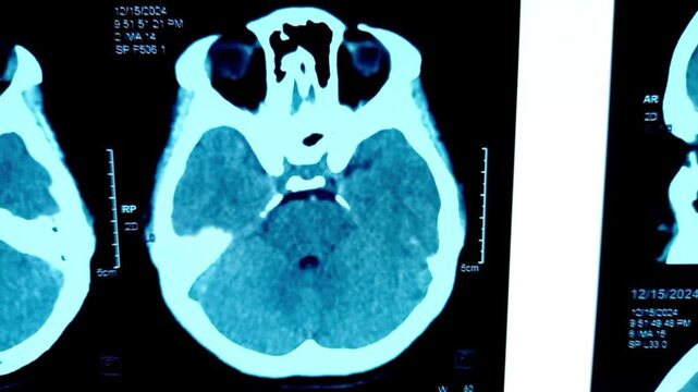 Multiple CT scan of human brain. Multiple axial views of the human head. 