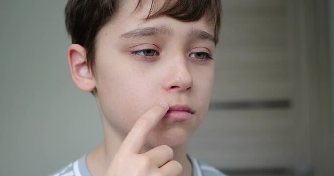 Concerned boy examines skin blemish at home. Introspection highlights youth's struggle with self-image. Natural light creates calm atmosphere for personal reflection.
