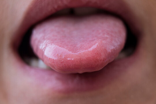 Human tongue showing taste buds and oral hygiene