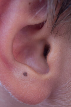Human ear close up with mole on earlobe