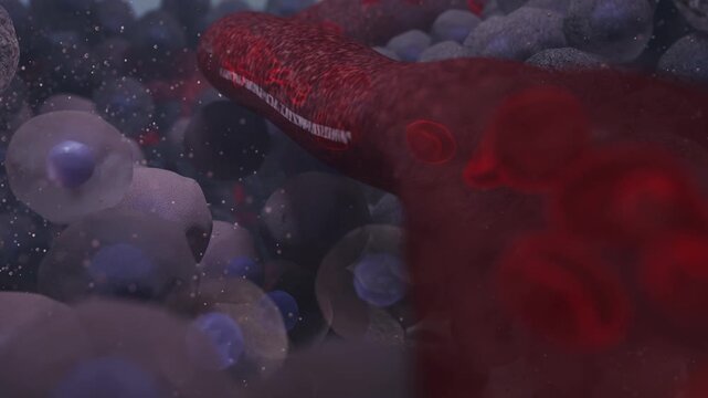Realistic 3D medical animation showing colorectal cancer progression and metastasis. Tumor cells divide, invade blood vessels and travel through the bloodstream among red blood cells. Cinematic micros