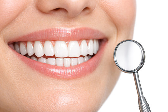 Close-up image of a woman's smile showing white and straight teeth.