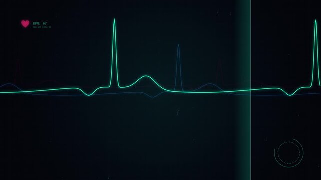 Digital Heartbeat EKG Monitor Displaying Vital Signs in Healthcare