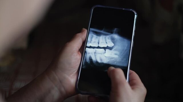 An unrecognizable woman looks at a close-up of a CT scan of her teeth