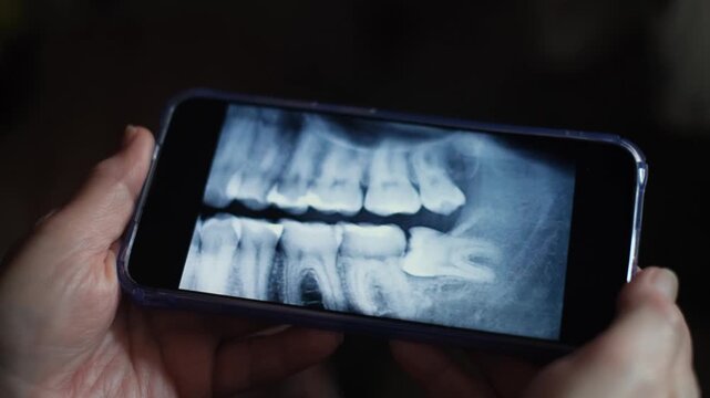 An unrecognizable woman looks at a close-up of a CT scan of her teeth. A wisdom tooth is visible in the frame.