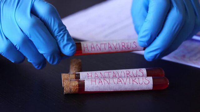 hantavirus blood sample labeling doctor hands blue gloves medical laboratory background dark surface pandemic clinical report with copy space for banner design concept of healthcare, medicine, science