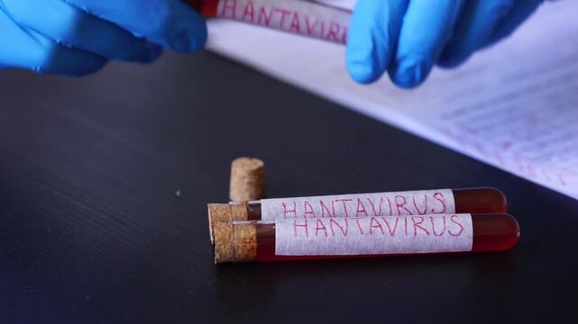 Hantavirus blood sample test tubes doctor hands blue gloves medical laboratory research surface pandemic clinical report with copy space for banner design concept of healthcare, medicine, science