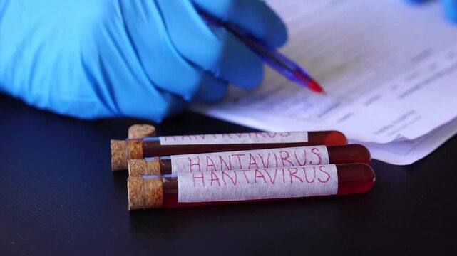 Hantavirus blood test tubes medical documents doctor hand blue glove laboratory research surface pandemic clinical report with copy space for banner design concept of healthcare, medicine, science
