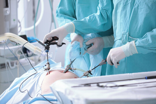 Surgeons perform laparoscopic surgery. Modern abdominal surgery. Surgical intervention through small holes. Penetration into abdominal cavity. Team of surgeons