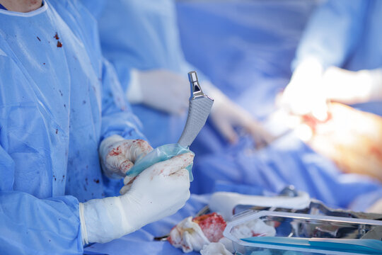 Surgeon Holding Hip Prosthesis During Orthopedic Surgery Procedure