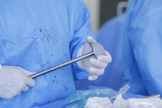 Surgeon Holding Prosthetic Hip Implant During Orthopedic Procedure