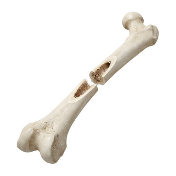Broken Femur Bone collection &mdash; realistic 3D render white background